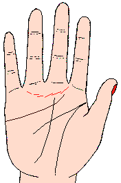 D10